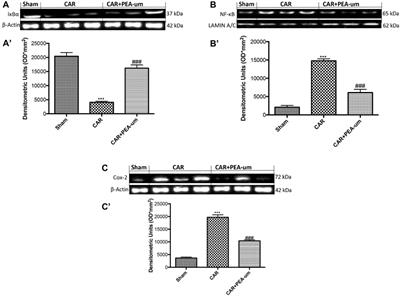 Corrigendum: Oral ultramicronized palmitoylethanolamide: plasma and tissue levels and spinal antihyperalgesic effect